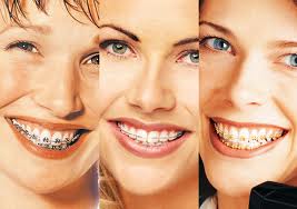 Ортодонтия